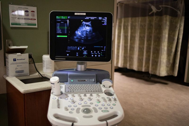 © Reuters. FILE PHOTO: A recently scanned monitor showing a patients ultrasound in Michigan, U.S., February 1, 2022.  REUTERS/Emily Elconin