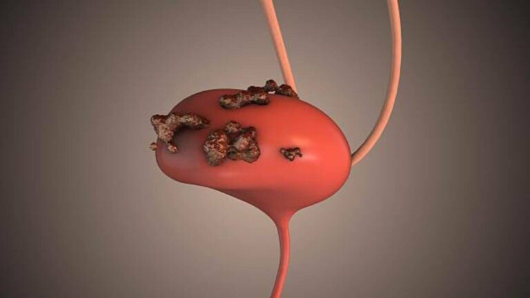 enGene Holdings: A Potential Oncology Entrant (NASDAQ:ENGN)